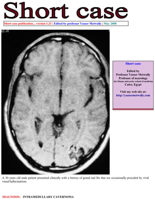 Short case publication... version 1.21 | Edited by professor Yasser Metwally | May 2008




                                                                                                      Short case

                                                                                                     Edited by
                                                                                             Professor Yasser Metwally
                                                                                               Professor of neurology
                                                                                           Ain Shams university school of medicine
                                                                                                      Cairo, Egypt

                                                                                                 Visit my web site at:
                                                                                              http://yassermetwally.com




A 30 years old male patient presented clinically with a history of grand mal fits that are occasionally preceded by vivid
visual hallucinations.




DIAGNOSIS: INTRAMEDULLARY CAVERNOMA
 