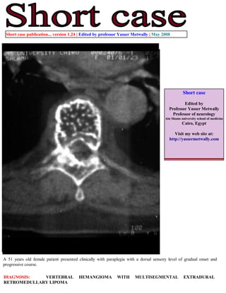 Short case publication... version 1.24 | Edited by professor Yasser Metwally | May 2008




                                                                                                  Short case

                                                                                                 Edited by
                                                                                         Professor Yasser Metwally
                                                                                           Professor of neurology
                                                                                       Ain Shams university school of medicine
                                                                                                  Cairo, Egypt

                                                                                            Visit my web site at:
                                                                                         http://yassermetwally.com




A 51 years old female patient presented clinically with paraplegia with a dorsal sensory level of gradual onset and
progressive course.

DIAGNOSIS:   VERTEBRAL                  HEMANGIOMA           WITH     MULTISEGMENTAL               EXTRADURAL
RETROMEDULLARY LIPOMA
 