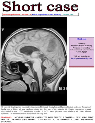 Short case publication... version 2.4 | Edited by professor Yasser Metwally | October 2008




                                                                                                     Short case

                                                                                                    Edited by
                                                                                            Professor Yasser Metwally
                                                                                              Professor of neurology
                                                                                          Ain Shams university school of medicine
                                                                                                     Cairo, Egypt

                                                                                               Visit my web site at:
                                                                                            http://yassermetwally.com




11 years old female patient presented with congenital left sided hemiaplasia and Lennox Gastaut syndrome. The patient's
family gave a history of west syndrome during the first year of the patient's life. Fundus examination revealed
chorioretinal lacunae. EEG examination revealed 1.5 C/S slow spike/slow wave discharge of Lennox Gastaut
syndrome. The patient's scholastic achievement was very poor.

DIAGNOSIS: AICARDI SYNDROME ASSOCIATED WITH MULTIPLE CORTICAL DYSPLASIAS THAT
INCLUDE HEMIMEGALENCEPHALY, LISSENCEPHALY, HETEROTOPIAS, AND SEPTO-OPTIC
DYSPLASIA.
 