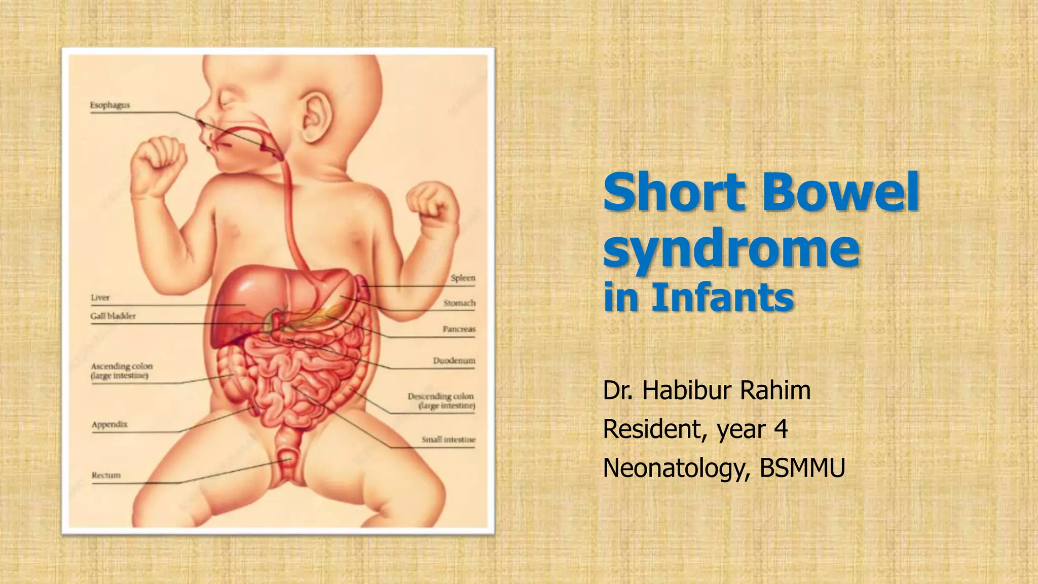 Short Bowel syndrome Dr Habibur Rahim PPT