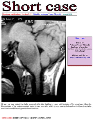 Short case publication... Version 3.15 | Edited by professor Yasser Metwally | March 2010




                                                                                                        Short case

                                                                                                       Edited by
                                                                                               Professor Yasser Metwally
                                                                                                 Professor of neurology
                                                                                             Ain Shams university school of medicine
                                                                                                        Cairo, Egypt

                                                                                                  Visit my web site at:
                                                                                               http://yassermetwally.com




11 years old male patient who had a history of right sided facial nerve palsy, with limitation of horizontal gaze bilaterally.
The condition of the patient remained stable for two years after which he was presented clinically with bilateral cerebellar
manifestation and bilateral pyramidal manifestations.




DIAGNOSIS: DIFFUSE INTRINSIC BRAIN STEM GLIOMA
 