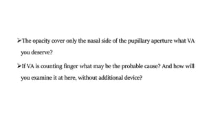 The opacity cover only the nasal side of the pupillary aperture what VA
you deserve?
If VA is counting finger what may be the probable cause? And how will
you examine it at here, without additional device?
 