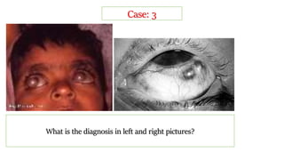 What is the diagnosis in left and right pictures?
Case: 3
 