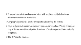 A central zone of stromal oedema, often with overlying epithelial oedema
occasionally the lesion is eccentric.
Large (granulomatous) keratic precipitates underlying the oedema
Folds in Descemet membrane in severe cases. A surrounding (Wessely) immune
ring of deep stromal haze signifies deposition of viral antigen and host antibody
complexes.
The IOP may be elevated.
 