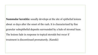Nummular keratitis: usually develops at the site of epithelial lesions
about 10 days after the onset of the rash. It is characterized by fine
granular subepithelial deposits surrounded by a halo of stromal haze.
The lesions fade in response to topical steroids but recur if
treatment is discontinued prematurely. (Kanski)
 