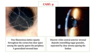 CASE: 9
Fine filamentous lattice opacity
throughout the cornea but clear space
among the opacity spares the periphery
A generalized stromal haze
Discrete white central anterior stromal
deposits resembling sugar granules,
separated by clear stroma sparing the
limbus
 