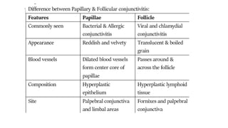 Short case Cornea