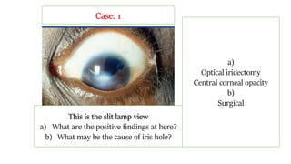 This is the slit lamp view
a) What are the positive findings at here?
b) What may be the cause of iris hole?
a)
Optical iridectomy
Central corneal opacity
b)
Surgical
Case: 1
 