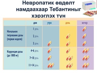 Невропатик өвдөлт
намдаахаар Тебантиныг
хэрэглэх тун

 