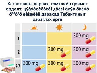 Хагалгааны дараах, гэмтлийн цочмог
өвдөлт, цýâýðøèëòèéì ¿åèéì äýýø õàëóó
õººðºõ øèìæèéã дарахад Тебантиныг
хэрэглэх арга

 
