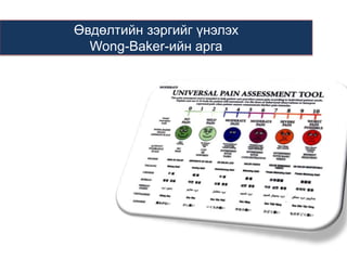 Өвдөлтийн зэргийг үнэлэх
Wong-Baker-ийн арга

 