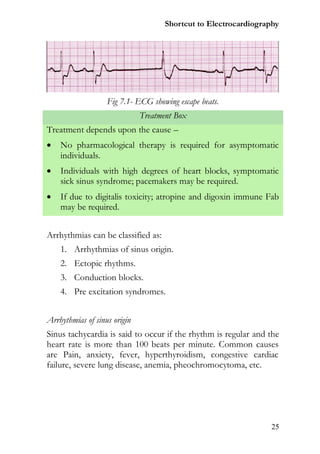 Shortcut to Electrocardiography




                   Fig 7.1- ECG showing escape beats.
                              Treatment Box
Treatment depends upon the cause –
   No pharmacological therapy is required for asymptomatic
    individuals.
   Individuals with high degrees of heart blocks, symptomatic
    sick sinus syndrome; pacemakers may be required.
   If due to digitalis toxicity; atropine and digoxin immune Fab
    may be required.


Arrhythmias can be classified as:
    1. Arrhythmias of sinus origin.
    2. Ectopic rhythms.
    3. Conduction blocks.
    4. Pre excitation syndromes.


Arrhythmias of sinus origin
Sinus tachycardia is said to occur if the rhythm is regular and the
heart rate is more than 100 beats per minute. Common causes
are Pain, anxiety, fever, hyperthyroidism, congestive cardiac
failure, severe lung disease, anemia, pheochromocytoma, etc.




                                                                 25
 