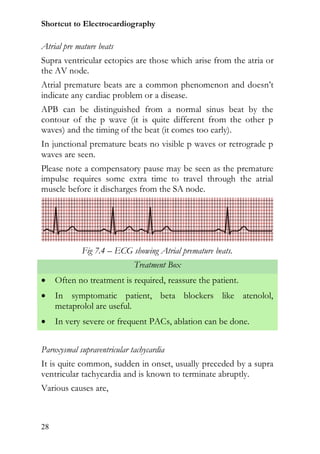 Shortcut to Electrocardiography

Atrial pre mature beats
Supra ventricular ectopics are those which arise from the atria or
the AV node.
Atrial premature beats are a common phenomenon and doesn’t
indicate any cardiac problem or a disease.
APB can be distinguished from a normal sinus beat by the
contour of the p wave (it is quite different from the other p
waves) and the timing of the beat (it comes too early).
In junctional premature beats no visible p waves or retrograde p
waves are seen.
Please note a compensatory pause may be seen as the premature
impulse requires some extra time to travel through the atrial
muscle before it discharges from the SA node.




            Fig 7.4 – ECG showing Atrial premature beats.
                             Treatment Box
    Often no treatment is required, reassure the patient.
    In symptomatic patient, beta blockers like atenolol,
     metaprolol are useful.
    In very severe or frequent PACs, ablation can be done.


Paroxysmal supraventricular tachycardia
It is quite common, sudden in onset, usually preceded by a supra
ventricular tachycardia and is known to terminate abruptly.
Various causes are,



28
 