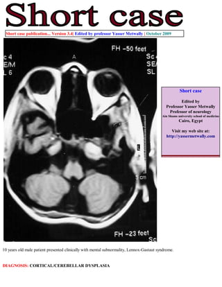 Short case publication... Version 3.4| Edited by professor Yasser Metwally | October 2009




                                                                                                     Short case

                                                                                                    Edited by
                                                                                            Professor Yasser Metwally
                                                                                              Professor of neurology
                                                                                          Ain Shams university school of medicine
                                                                                                     Cairo, Egypt

                                                                                               Visit my web site at:
                                                                                            http://yassermetwally.com




10 years old male patient presented clinically with mental subnormality, Lennox-Gastaut syndrome.


DIAGNOSIS: CORTICAL/CEREBELLAR DYSPLASIA
 