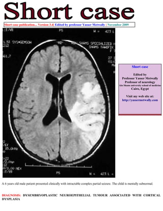 Short case publication... Version 3.4| Edited by professor Yasser Metwally | November 2009




                                                                                                         Short case

                                                                                                        Edited by
                                                                                                Professor Yasser Metwally
                                                                                                  Professor of neurology
                                                                                              Ain Shams university school of medicine
                                                                                                         Cairo, Egypt

                                                                                                    Visit my web site at:
                                                                                                 http://yassermetwally.com




A 6 years old male patient presented clinically with intractable complex partial seizure. The child is mentally subnormal.


DIAGNOSIS: DYSEMBRYOPLASTIC NEUROEPITHELIAL TUMOUR ASSOCIATED WITH CORTICAL
DYSPLASIA
 