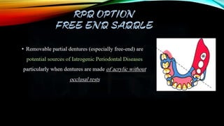Shortened dental arch sda | PPTX