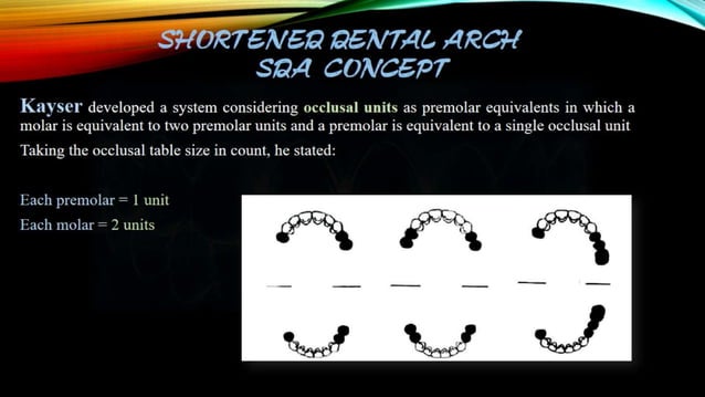 shortened-dental-arch-sda-pptx