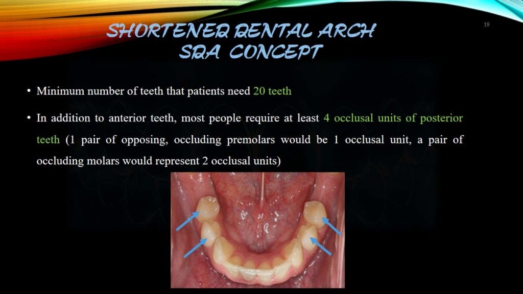 Shortened dental arch sda