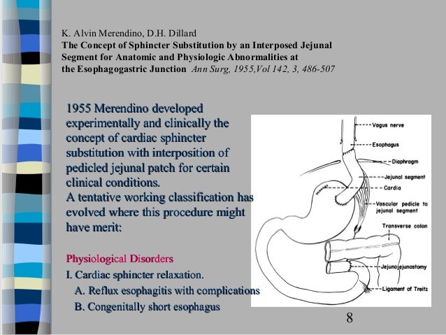 Sandifer Reflex Sanderford Syndrome Reflux : Sandifer syndrome : JAAPA – WWNIZ