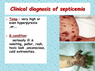 new update Short febril illness 2024 New.ppt