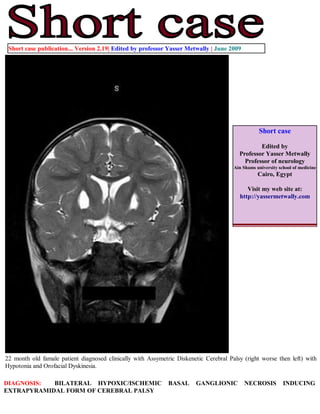 Short case publication... Version 2.19| Edited by professor Yasser Metwally | June 2009




                                                                                                  Short case

                                                                                                 Edited by
                                                                                         Professor Yasser Metwally
                                                                                           Professor of neurology
                                                                                       Ain Shams university school of medicine
                                                                                                  Cairo, Egypt

                                                                                            Visit my web site at:
                                                                                         http://yassermetwally.com




22 month old famale patient diagnosed clinically with Assymetric Diskenetic Cerebral Palsy (right worse then left) with
Hypotonia and Orofacial Dyskinesia.

DIAGNOSIS:  BILATERAL HYPOXIC/ISCHEMIC                        BASAL     GANGLIONIC         NECROSIS           INDUCING
EXTRAPYRAMIDAL FORM OF CEREBRAL PALSY
 