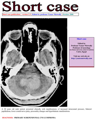 Short case publication... version 2.3 | Edited by professor Yasser Metwally | October 2008




                                                                                                Short case

                                                                                                Edited by
                                                                                        Professor Yasser Metwally
                                                                                          Professor of neurology
                                                                                     Ain Shams university school of medicine
                                                                                                Cairo, Egypt

                                                                                           Visit my web site at:
                                                                                        http://yassermetwally.com




A 30 years old male patient presented clinically with manifestations of increased intracranial pressure, bilateral
papilledema, lower cranial nerve palsy, personality changes and hypothalamic manifestations


DIAGNOSIS: PRIMARY SUBEPENDYMAL CNS LYMPHOMA
 