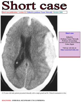 Short case publication... version 2.2 | Edited by professor Yasser Metwally | October 2008




                                                                                                          Short case

                                                                                                          Edited by
                                                                                                  Professor Yasser Metwally
                                                                                                    Professor of neurology
                                                                                               Ain Shams university school of medicine
                                                                                                          Cairo, Egypt

                                                                                                     Visit my web site at:
                                                                                                  http://yassermetwally.com




 A 32 years old male patient presented clinically with a single grand mal fit. Clinical examination is free.



DIAGNOSIS: EPIDURAL SECONDARY CNS LYMPHOMA
 