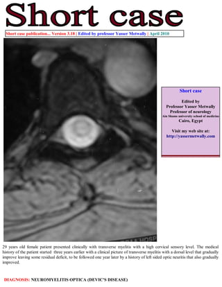 Short case publication... Version 3.18 | Edited by professor Yasser Metwally | April 2010




                                                                                                            Short case

                                                                                                           Edited by
                                                                                                   Professor Yasser Metwally
                                                                                                     Professor of neurology
                                                                                                 Ain Shams university school of medicine
                                                                                                            Cairo, Egypt

                                                                                                       Visit my web site at:
                                                                                                    http://yassermetwally.com




29 years old female patient presented clinically with transverse myelitis with a high cervical sensory level. The medical
history of the patient started three years earlier with a clinical picture of transverse myelitis with a dorsal level that gradually
improve leaving some residual deficit, to be followed one year later by a history of left sided optic neuritis that also gradually
improved.



 DIAGNOSIS: NEUROMYELITIS OPTICA (DEVIC'S DISEASE)
 