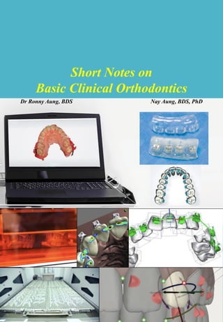 Short Notes on
Basic Clinical Orthodontics
Dr Ronny Aung, BDS Nay Aung, BDS, PhD
 