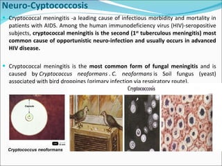 Neuro-Cyptococcosis Cryptococcal meningitis -a leading cause of infectious morbidity and mortality in patients with AIDS. Among the human immunodeficiency virus (HIV)-seropositive subjects,  cryptococcal meningitis is the second (1 st  tuberculous meningitis) most common cause of opportunistic neuro-infection and usually occurs in advanced HIV disease.  Cryptococcal meningitis is the  most common form of fungal meningitis  and is caused by  Cryptococcus neoformans  .  C. neoformans  is Soil fungus (yeast) associated with bird droppings (primary infection via respiratory route).    Cryptococcus neoformans 
