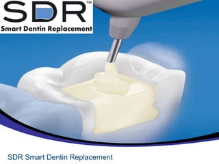 SDR Smart Dentin Replacement 