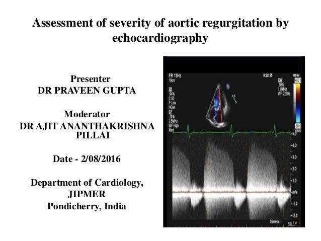 Echocardiography Assessment Of Aortic Regurgitation Severity Echocardiography Assessment Of Aortic Regurgitation Severity