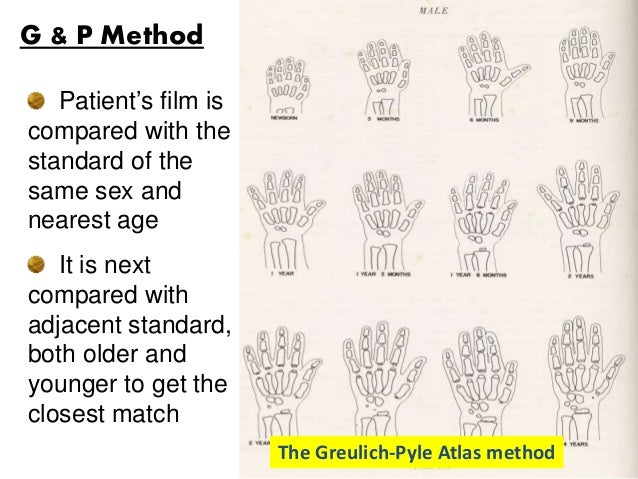 short stature stature for age growth chart