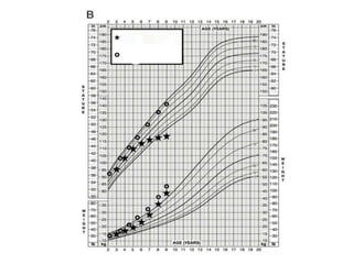 Short stature | PPTX