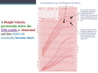 Short Stature.pptx