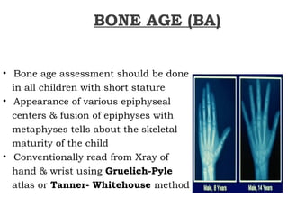 BONE AGE (BA)
• Bone age assessment should be done
in all children with short stature
• Appearance of various epiphyseal
centers & fusion of epiphyses with
metaphyses tells about the skeletal
maturity of the child
• Conventionally read from Xray of
hand & wrist using Gruelich-Pyle
atlas or Tanner- Whitehouse method
 