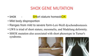 SHOX GENE MUTATION
• SHOX - SHort stature homeobOX
• Mild body disproportion
• Ranges from mild to severe form-Leri-Weill dyschondrosteosis
• LWS is triad of short stature, mesomelia, and Madelung deformity.
• SHOX mutation also associated with short phenotype in Turner's
syndrome.
 