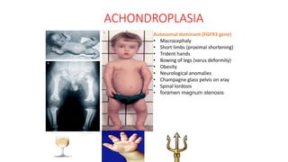 ACHONDROPLASIA
Autosomal dominant (FGFR3 gene)
• Macrocephaly
• Short limbs (proximal shortening)
• Trident hands
• Bowing of legs (varus deformity)
• Obesity
• Neurological anomalies
• Champagne glass pelvis on xray
• Spinal lordosis
• foramen magnum stenosis
 
