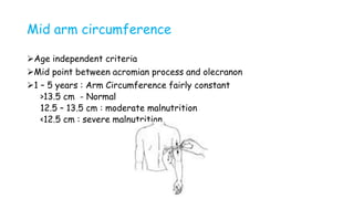 Mid arm circumference
Age independent criteria
Mid point between acromian process and olecranon
1 – 5 years : Arm Circumference fairly constant
>13.5 cm - Normal
12.5 – 13.5 cm : moderate malnutrition
<12.5 cm : severe malnutrition
 