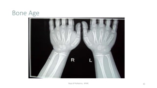 Bone Age
Dept of Pediatrics, AFMC 43
 