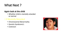 What Next ?
Again look at the child
• Whether child is mentally retarded
or normal
• If Mentally Retarded
• Chromosomal Abnormality
• Genetic Syndrome’s
• Cretinism
 