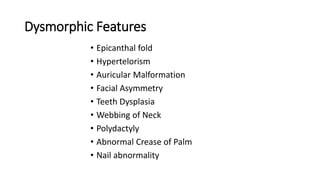 Dysmorphic Features
• Epicanthal fold
• Hypertelorism
• Auricular Malformation
• Facial Asymmetry
• Teeth Dysplasia
• Webbing of Neck
• Polydactyly
• Abnormal Crease of Palm
• Nail abnormality
 