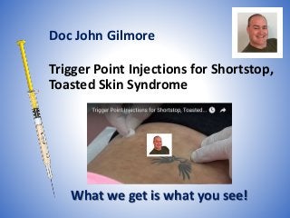 Trigger Point Injections for Shortstop,
Toasted Skin Syndrome
What we get is what you see!
Doc John Gilmore
 