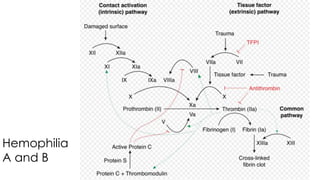 Hemophilia
A and B
 