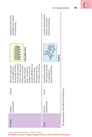 91
Parasites
Nodose
conjunctivitis
Chronic
Very
rare
conjunctivi-
tis.
Caterpillar
hairs
accidentally
find
their
way
into
the
conjuncti-
val
sac.
The
hairs
have
barbs
and
work
their
way
deep
into
the
tissue.
Granulomas
develop
on
the
con-
junctiva.
Blindness
can
result
when
these
hairs
penetrate
into
the
interior
of
the
eye.
Caterpillar
hairs
Surgical
removal
of
the
caterpillar
hairs,
topical
steroid
therapy
Fungi
Mycotic
conjunctivitis
Acute
Frequently
associated
with
mycotic
keratitis
or
secondary
to
mycotic
canaliculitis
Hyphae
As
with
mycotic
keratitis:
systemic
and
topical
antimycotic
therapy
*
See
Appendix
for
side
effects
of
medications
4.4 Conjunctivitis
Lang, Ophthalmology © 2000 Thieme
All rights reserved. Usage subject to terms and conditions of license.
 