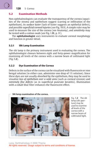 120
5.2 Examination Methods
Non-ophthalmologists can evaluate the transparency of the cornea (opaci-
ties of the stroma and epithelium suggest scarring or infiltration of the
epithelium), its surface luster (lack of luster suggests an epithelial defect),
and possible superficial corneal injuries (see Fig. 19.1). A simple ruler may be
used to measure the size of the cornea (see Anatomy), and sensitivity may
be tested with a cotton swab (see Fig. 1.11, p. 11).
The ophthalmologist uses instruments to evaluate corneal morphology
and function in greater detail.
5.2.1 Slit Lamp Examination
The slit lamp is the primary instrument used in evaluating the cornea. The
ophthalmologist chooses between eight and forty-power magnification for
examining all levels of the cornea with a narrow beam of collimated light
(Fig. 5.2).
5.2.2 Dye Examination of the Cornea
Defects in the surface of the cornea can be visualized with fluorescein or rose
bengal solution (in either case, administer one drop of 1% solution). Since
these dyes are not usually absorbed by the epithelium, they may be used to
visualize loss of epithelium over a wide area (such as corneal erosion) and
extremely fine defects (as in superficial punctate keratitis). Illumination
with a cobalt blue filter enhances the fluorescent effect.
Slit lamp examination of the cornea.
Fig. 5.2 The slit
lamp (slit aper-
ture) may be
used to examine
all levels of the
cornea with a
narrow beam of
collimated light.
5 Cornea
Lang, Ophthalmology © 2000 Thieme
All rights reserved. Usage subject to terms and conditions of license.
 