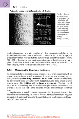 124
analysis is necessary when the number of cells appears extremely low under
slit lamp examination and the patient is a candidate for cataract surgery. If
exact analysis then verifies that the number of cells is extremely low (below
300–400 cells per mm2
), cataract surgery is combined with a corneal trans-
plant. This is done to ensure that the patient will be able to see even after cat-
aract surgery, which sacrifices additional endothelial cells.
5.2.6 Measuring the Diameter of the Cornea
An abnormally large or small cornea (megalocornea or microcornea) will be
apparent from simple visual inspection. A suspected size anomaly can be
easily verified by measuring the cornea with a ruler. Corneal diameter may
be determined more accurately with calipers (usually done under general
anesthesia, see Fig. 10.21) or with the Wessely keratometer. This is a type of
tube with a condensing lens with millimeter graduations at one end. The
examiner places this end on the patient’s eye and looks through the other
end.
Megalocornea in an infant always requires further diagnostic investigation
to determine whether buphthalmos is present. Microcornea may be a sign of
congenital defects in other ocular tissues that could result in impaired func-
tion (microphthalmos).
Automatic measurement of endothelial cell density.
Fig. 5.4 Specu-
lar microscopy
permits a precise
endothelial cell
count (CD = 2159
endothelial cells
per mm2
) while
simultaneously
measuring the
thickness of the
cornea (pachy-
metry;
pachy = 572 µm).
5 Cornea
Lang, Ophthalmology © 2000 Thieme
All rights reserved. Usage subject to terms and conditions of license.
 
