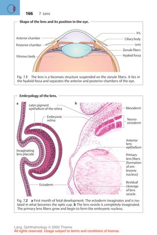 166
Embryology of the lens.
Fig. 7.2 a First month of fetal development: The ectoderm invaginates and is iso-
lated in what becomes the optic cup. b The lens vesicle is completely invaginated.
The primary lens fibers grow and begin to form the embryonic nucleus.
Shape of the lens and its position in the eye.
Anterior chamber
Posterior chamber
Vitreous body
Lens
Iris
Zonule fibers
Ciliary body
Hyaloid fossa
Fig. 7.1 The lens is a biconvex structure suspended on the zonule fibers. It lies in
the hyaloid fossa and separates the anterior and posterior chambers of the eye.
7 Lens
Lang, Ophthalmology © 2000 Thieme
All rights reserved. Usage subject to terms and conditions of license.
 
