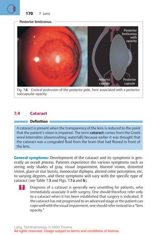 170
Posterior lenticonus.
Fig. 7.6 Conical protrusion of the posterior pole, here associated with a posterior
subcapsular opacity.
7.4 Cataract
Definition
A cataract is present when the transparency of the lens is reduced to the point
that the patient’s vision is impaired. The term cataract comes from the Greek
word katarraktes (downrushing; waterfall) because earlier it was thought that
the cataract was a congealed fluid from the brain that had flowed in front of
the lens.
General symptoms: Development of the cataract and its symptoms is gen-
erally an occult process. Patients experience the various symptoms such as
seeing only shades of gray, visual impairment, blurred vision, distorted
vision, glare or star bursts, monocular diplopia, altered color perception, etc.
to varying degrees, and these symptoms will vary with the specific type of
cataract (see Table 7.3 and Figs. 7.7a and b).
Diagnosis of a cataract is generally very unsettling for patients, who
immediately associate it with surgery. One should therefore refer only
to a cataract when it has been established that surgery is indicated. If
the cataract has not progressed to an advanced stage or the patient can
cope well with the visual impairment, one should refer instead to a “lens
opacity.”
7 Lens
Lang, Ophthalmology © 2000 Thieme
All rights reserved. Usage subject to terms and conditions of license.
 