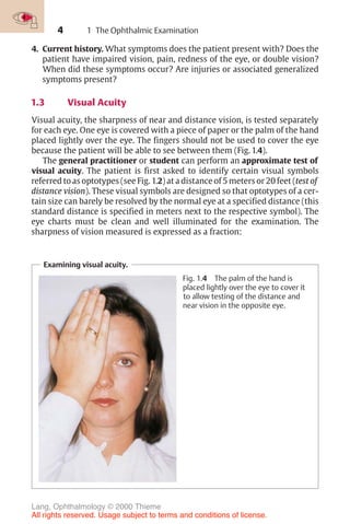 4
4. Current history. What symptoms does the patient present with? Does the
patient have impaired vision, pain, redness of the eye, or double vision?
When did these symptoms occur? Are injuries or associated generalized
symptoms present?
1.3 Visual Acuity
Visual acuity, the sharpness of near and distance vision, is tested separately
for each eye. One eye is covered with a piece of paper or the palm of the hand
placed lightly over the eye. The fingers should not be used to cover the eye
because the patient will be able to see between them (Fig. 1.4).
The general practitioner or student can perform an approximate test of
visual acuity. The patient is first asked to identify certain visual symbols
referred to as optotypes (see Fig. 1.2) at a distance of 5 meters or 20 feet (test of
distance vision). These visual symbols are designed so that optotypes of a cer-
tain size can barely be resolved by the normal eye at a specified distance (this
standard distance is specified in meters next to the respective symbol). The
eye charts must be clean and well illuminated for the examination. The
sharpness of vision measured is expressed as a fraction:
Examining visual acuity.
Fig. 1.4 The palm of the hand is
placed lightly over the eye to cover it
to allow testing of the distance and
near vision in the opposite eye.
1 The Ophthalmic Examination
Lang, Ophthalmology © 2000 Thieme
All rights reserved. Usage subject to terms and conditions of license.
 